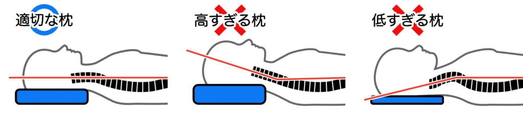 枕の高さとストレートネックに関係