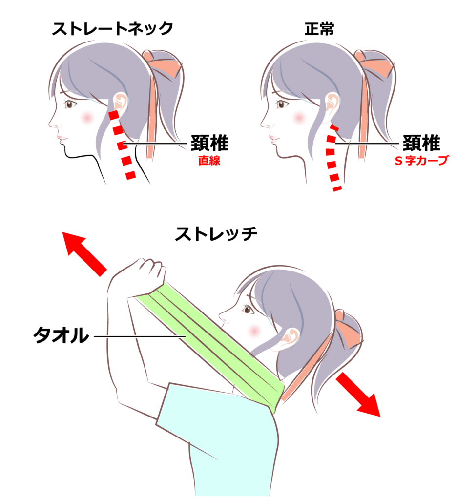 ストレートネック体操