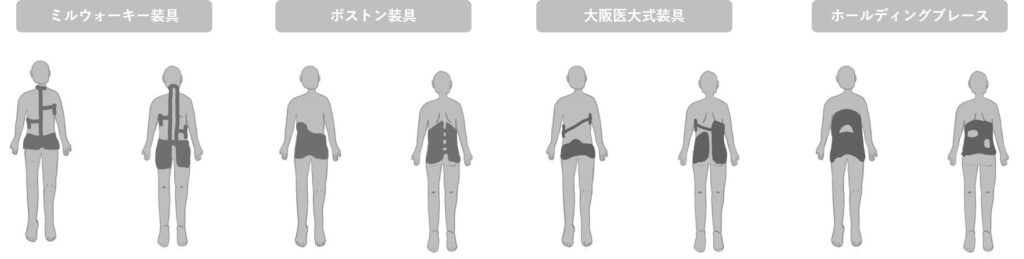 側弯症の装具