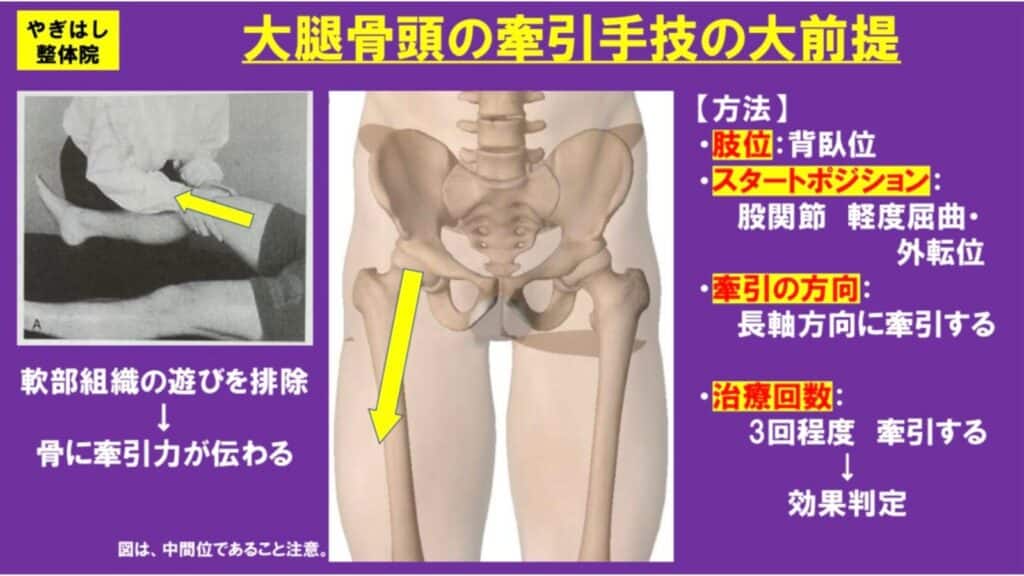 大腿骨頭の詰まりを解消する