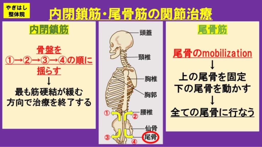 坐骨神経痛の治療4