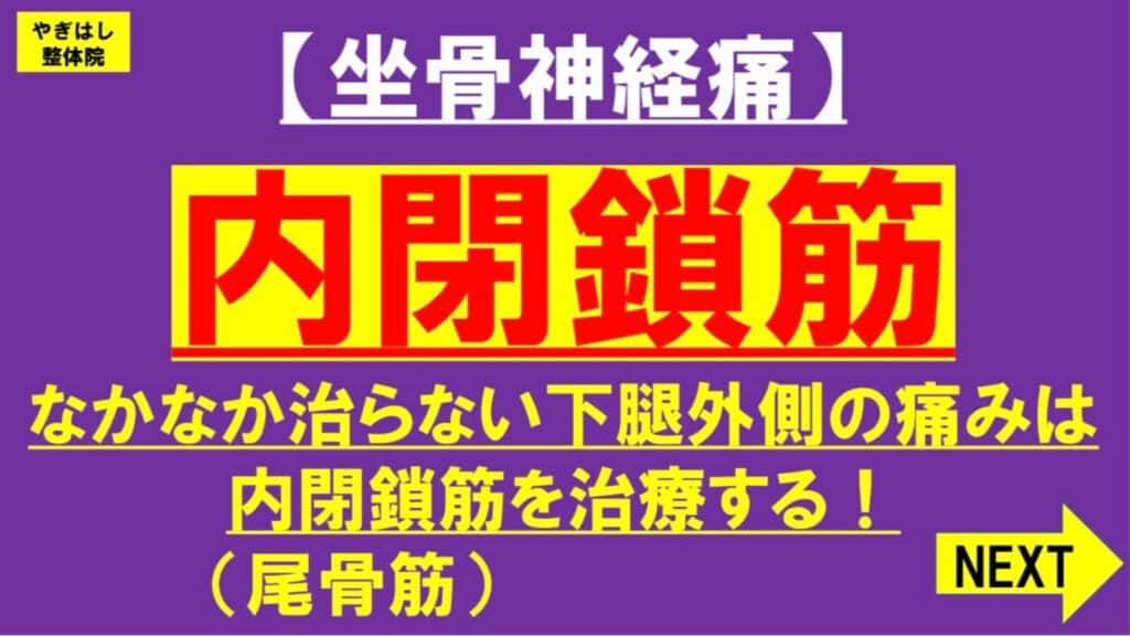 坐骨神経痛の治療