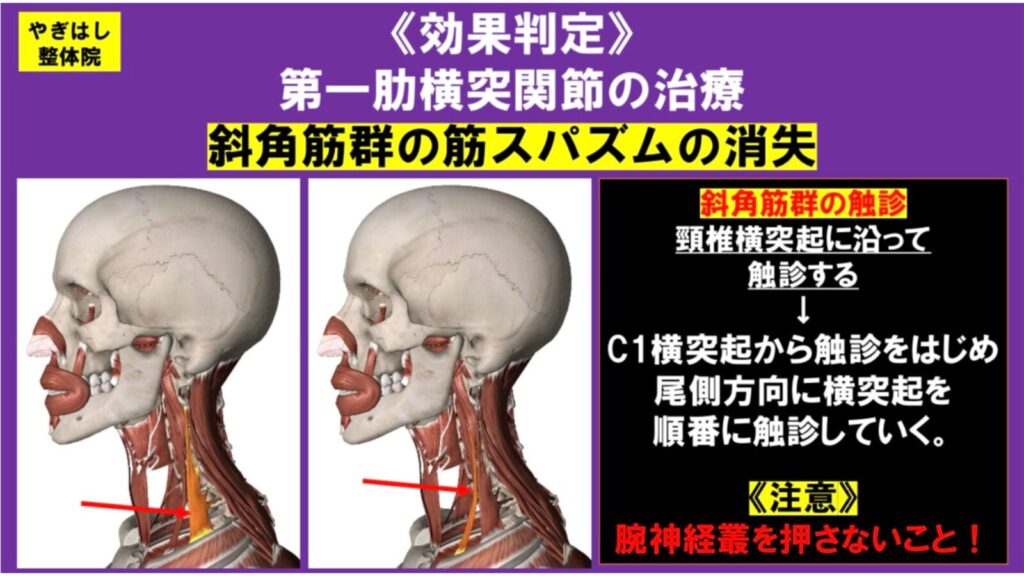 首の関節への治療３