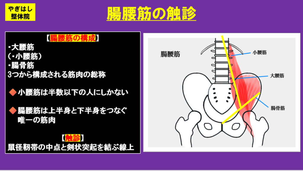 腸骨筋アプローチ1