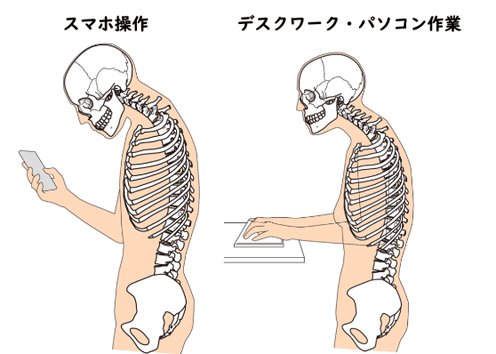 スマホ首の原因2