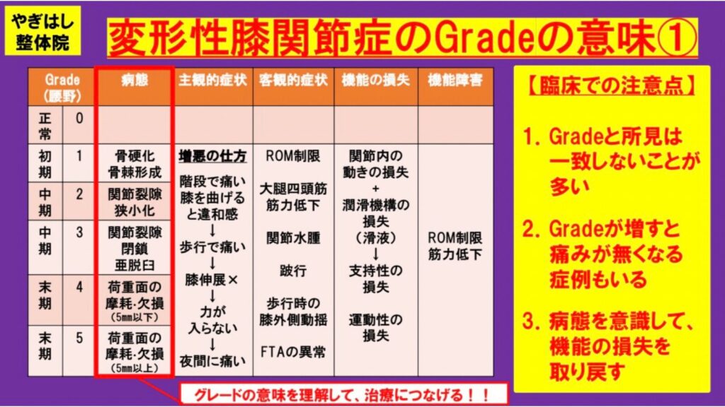 膝の痛み：半月板の治療
