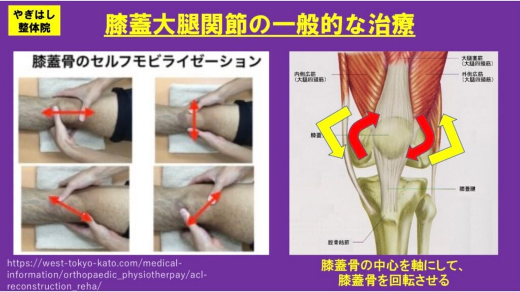 膝の痛み：膝蓋骨