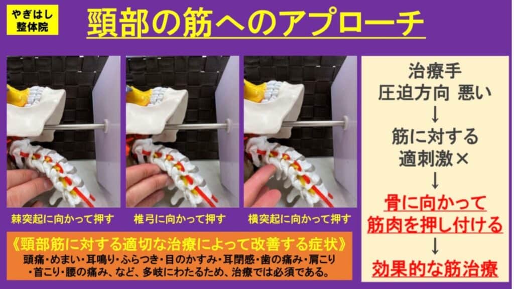 首の筋肉への治療３