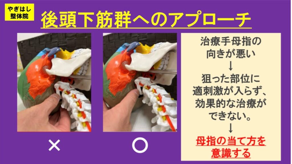 首の筋肉への治療