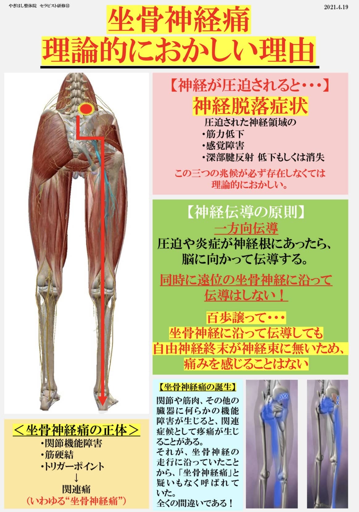 坐骨神経痛の真実