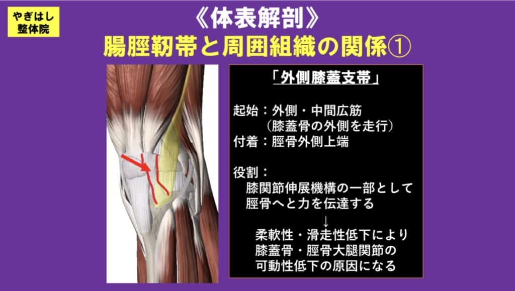 膝の痛み：腸脛靭帯の治療