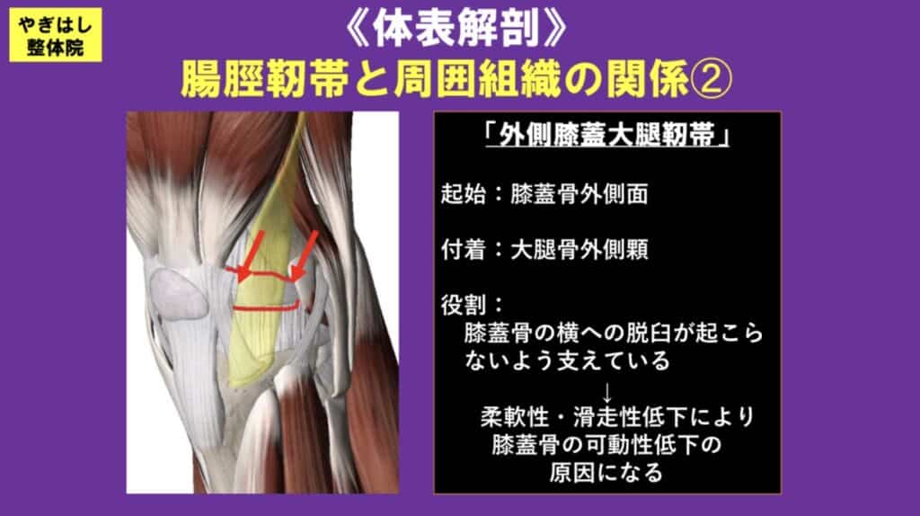 膝の痛み：腸脛靭帯の治療