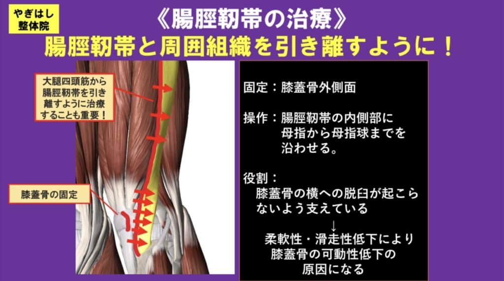 膝の痛み：腸脛靭帯の治療