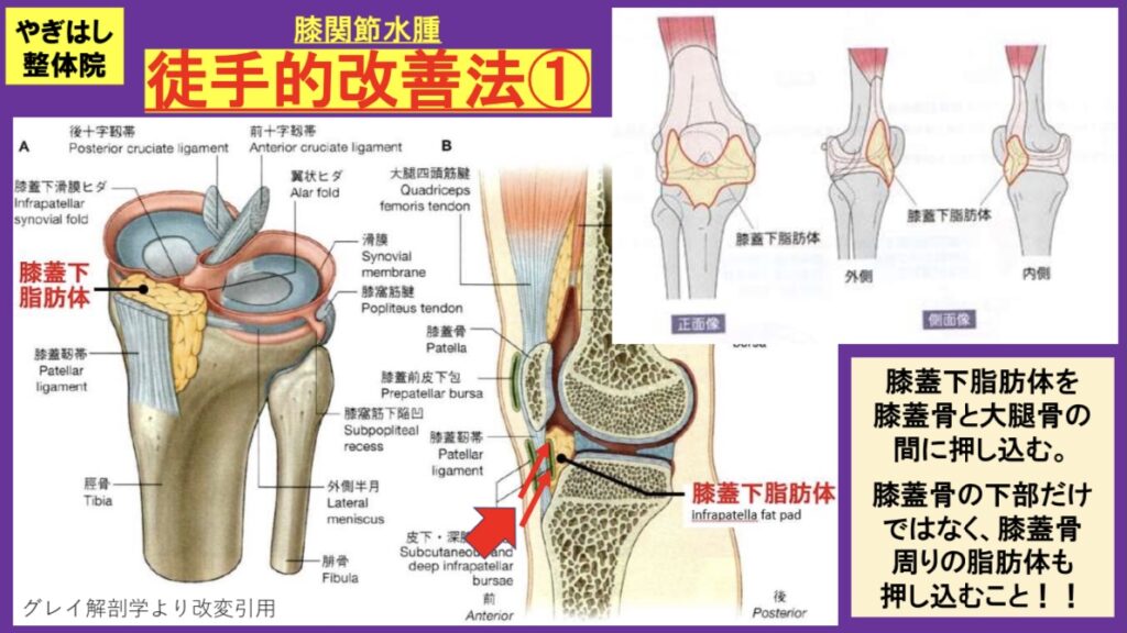 お膝の水を抜く治療
