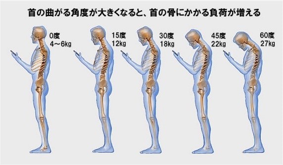 スマホ首の原因