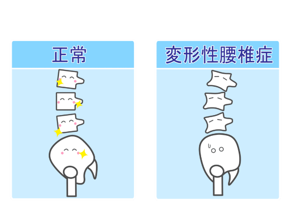 スマホ首と背骨