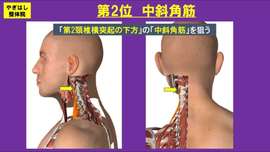 肩こり:斜角筋群