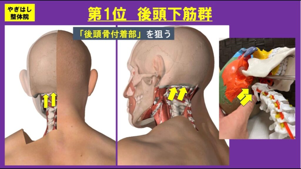 肩こり:後頭下筋群